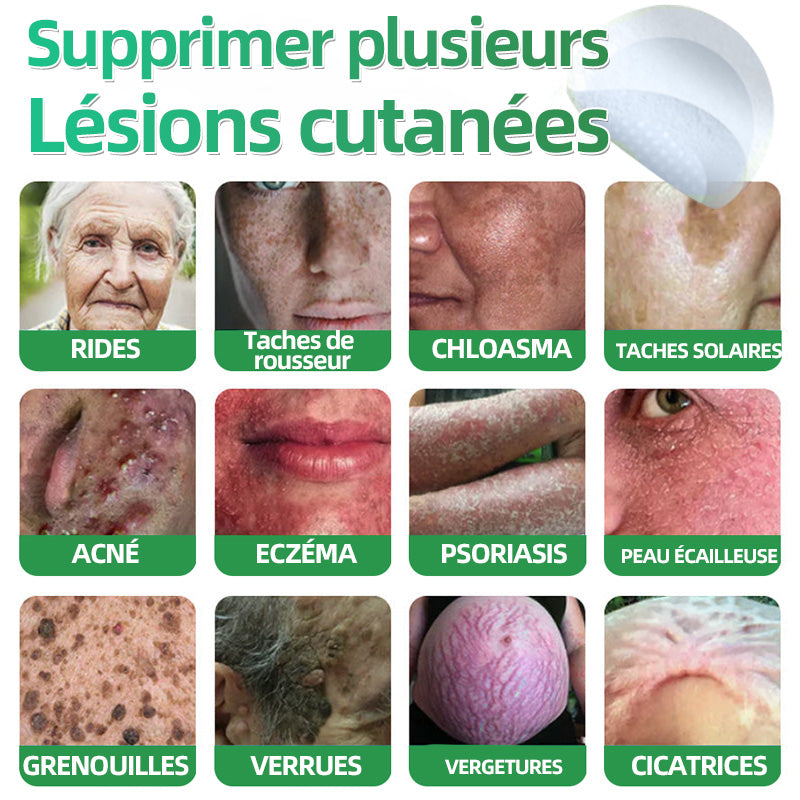 ✅ Patchs hydrocolloïdes à micro-aiguilles 2 en 1 𝐇𝐮𝐝𝐫𝐨s® | Élimine les grains de beauté en relief, l'acné, les verrues planes et les acrochordons | Patchs invisibles pour le visage et le corps | 144 patchs