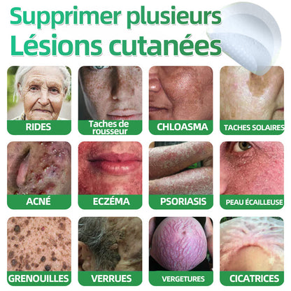 ✅ Patchs hydrocolloïdes à micro-aiguilles 2 en 1 𝐇𝐮𝐝𝐫𝐨s® | Élimine les grains de beauté en relief, l'acné, les verrues planes et les acrochordons | Patchs invisibles pour le visage et le corps | 144 patchs