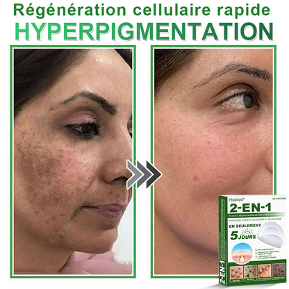 ✅ Patchs hydrocolloïdes à micro-aiguilles 2 en 1 𝐇𝐮𝐝𝐫𝐨s® | Élimine les grains de beauté en relief, l'acné, les verrues planes et les acrochordons | Patchs invisibles pour le visage et le corps | 144 patchs