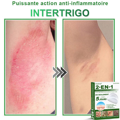 ✅ Patchs hydrocolloïdes à micro-aiguilles 2 en 1 𝐇𝐮𝐝𝐫𝐨s® | Élimine les grains de beauté en relief, l'acné, les verrues planes et les acrochordons | Patchs invisibles pour le visage et le corps | 144 patchs