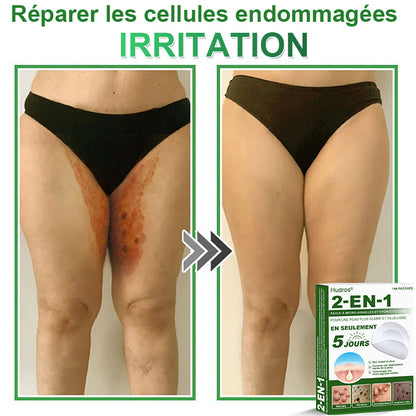 ✅ Patchs hydrocolloïdes à micro-aiguilles 2 en 1 𝐇𝐮𝐝𝐫𝐨s® | Élimine les grains de beauté en relief, l'acné, les verrues planes et les acrochordons | Patchs invisibles pour le visage et le corps | 144 patchs